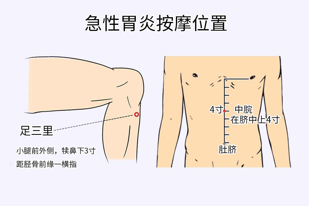 急性胃炎按摩位置图