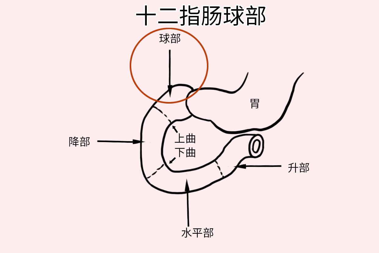 十二指肠解剖球部图片