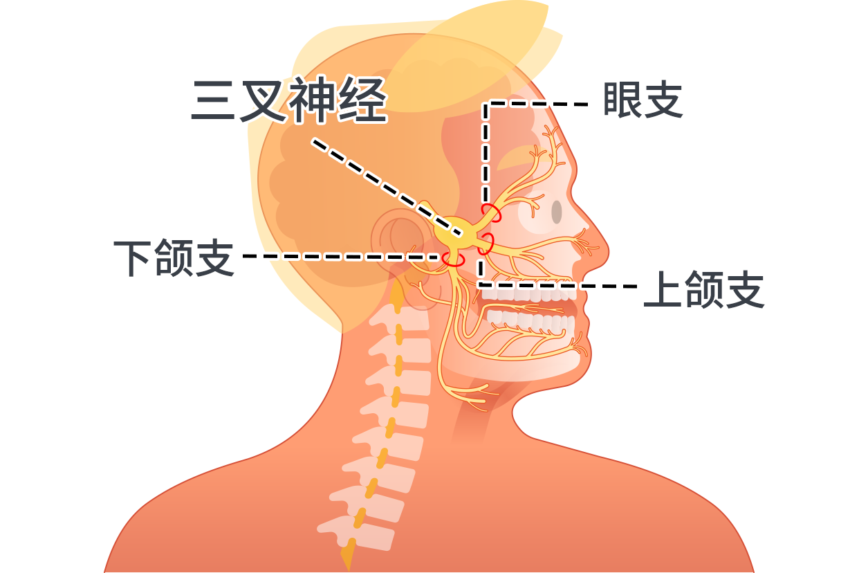 三叉神经解剖图