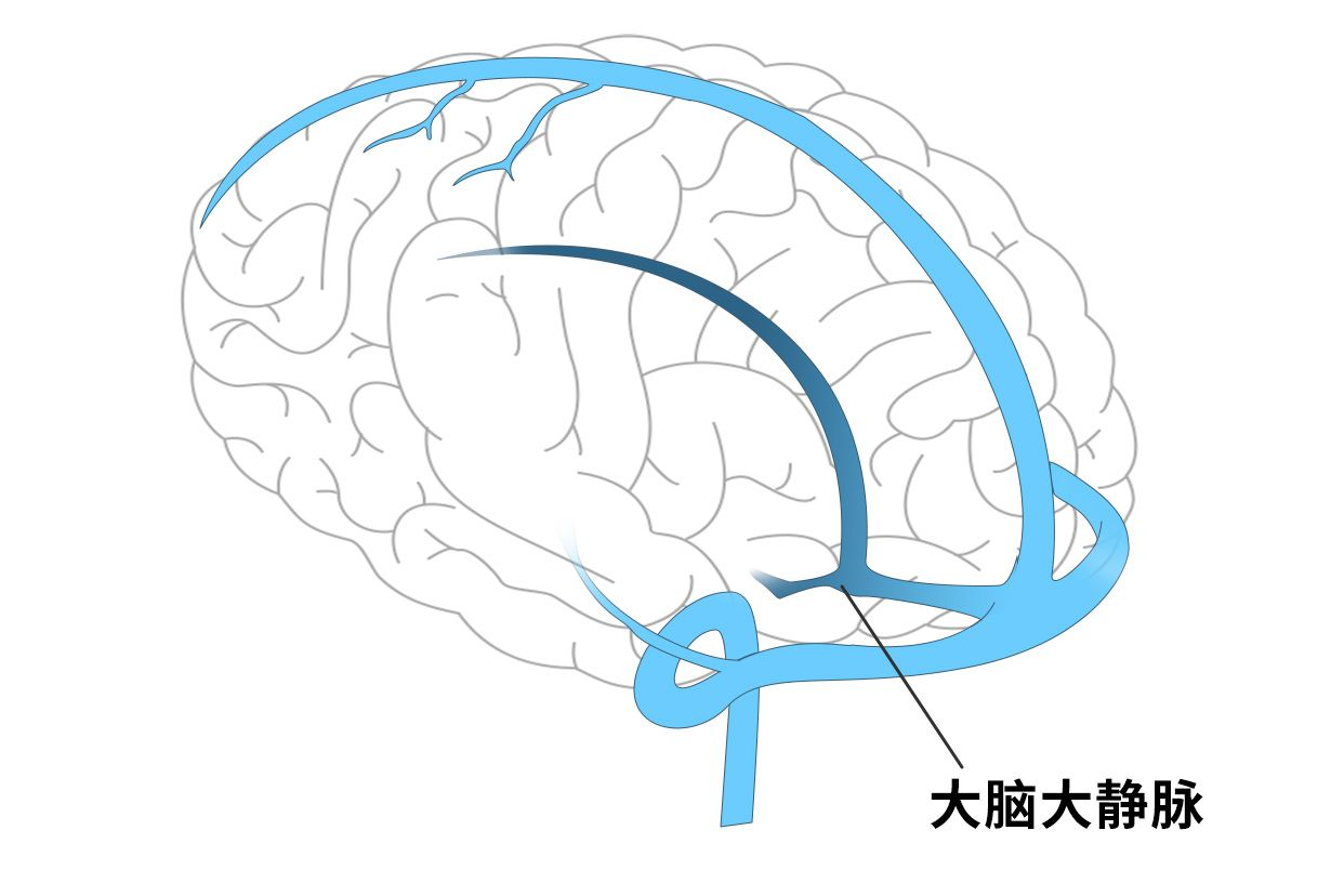 大脑大静脉解剖图