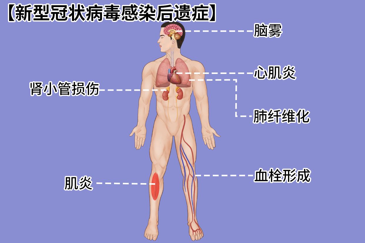 新型冠状病毒感染后遗症图片