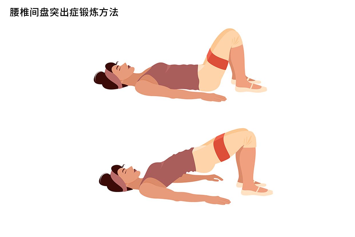 腰椎间盘突出症的锻炼方法图
