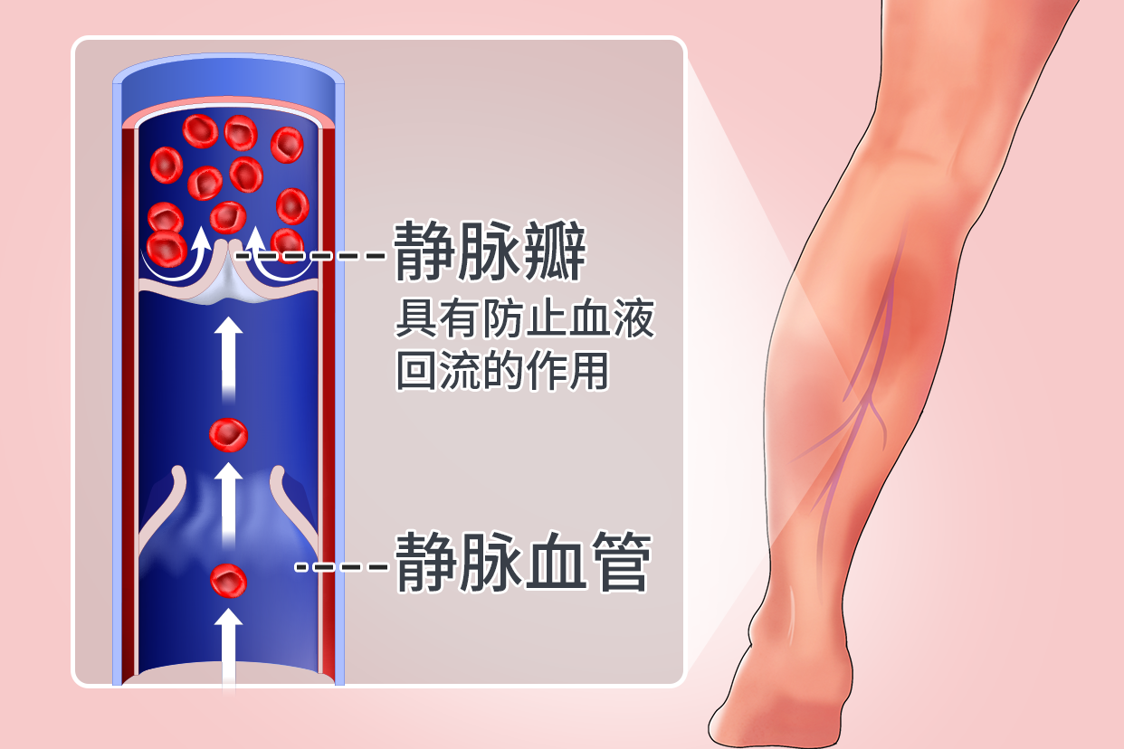 静脉瓣位置图片