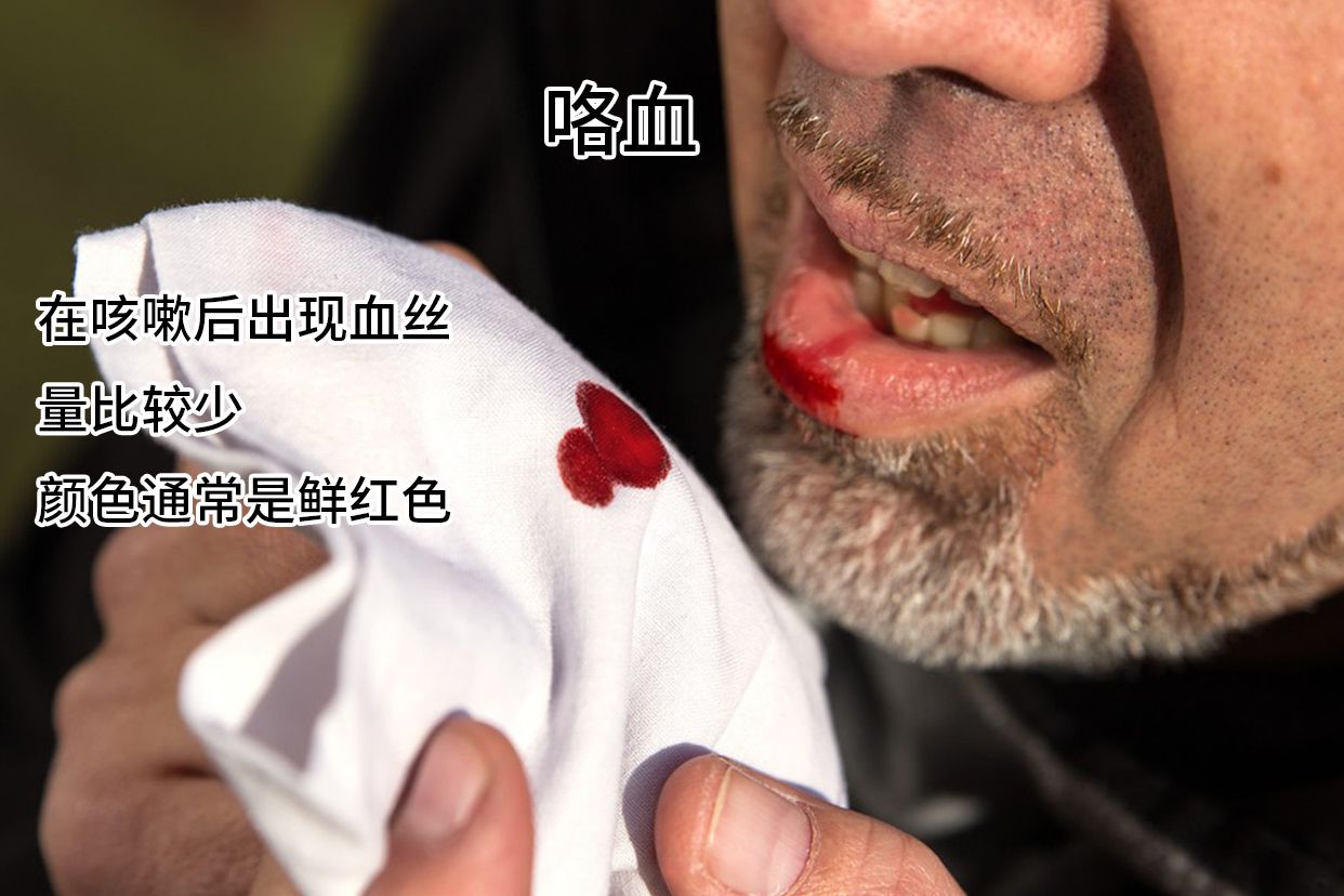 呕血与咯血的鉴别图