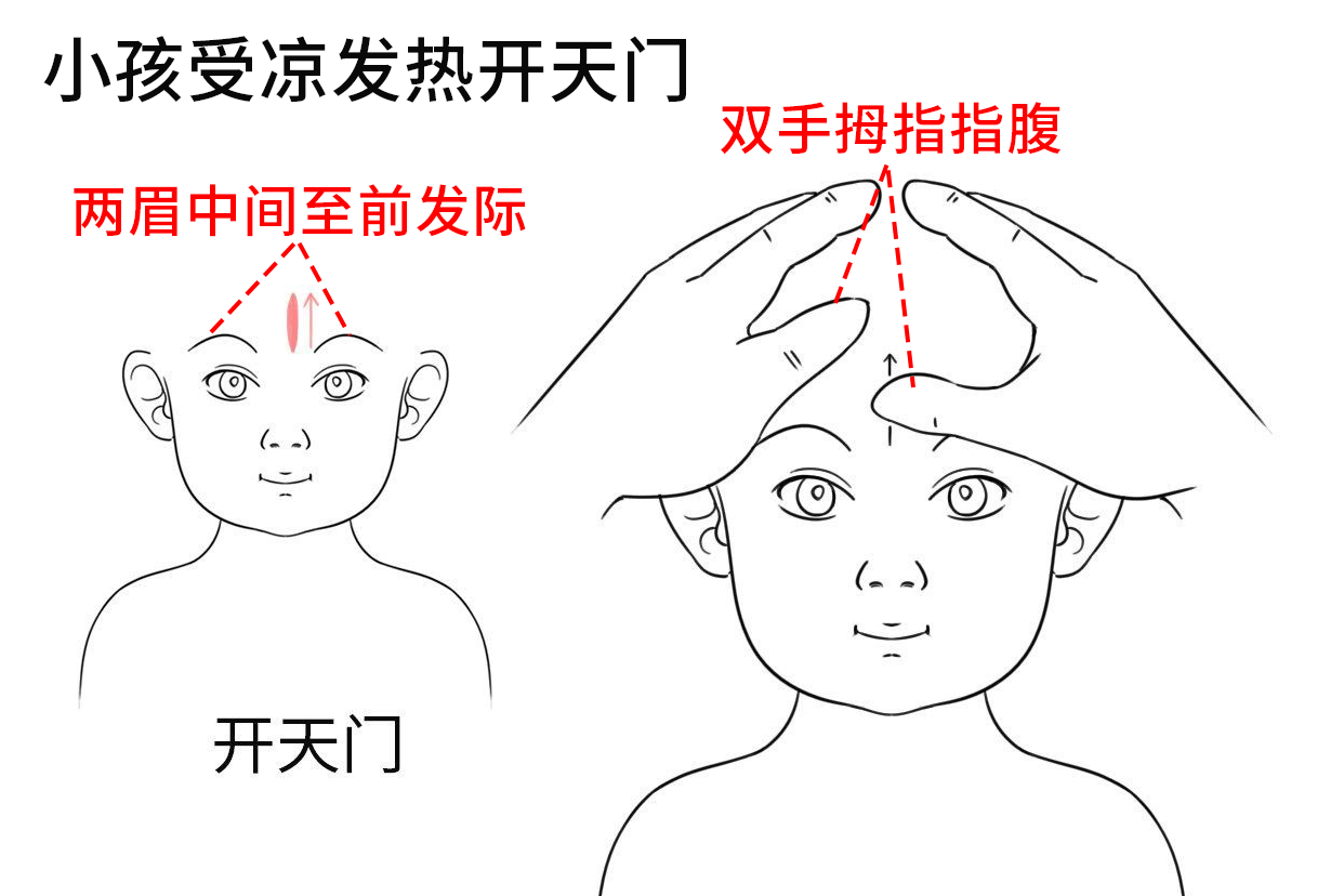 小孩发热可通过开天门,清天河水的推拿手法缓解