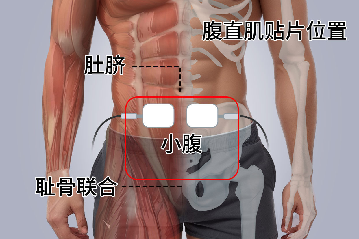 腹直肌贴片贴的位置图