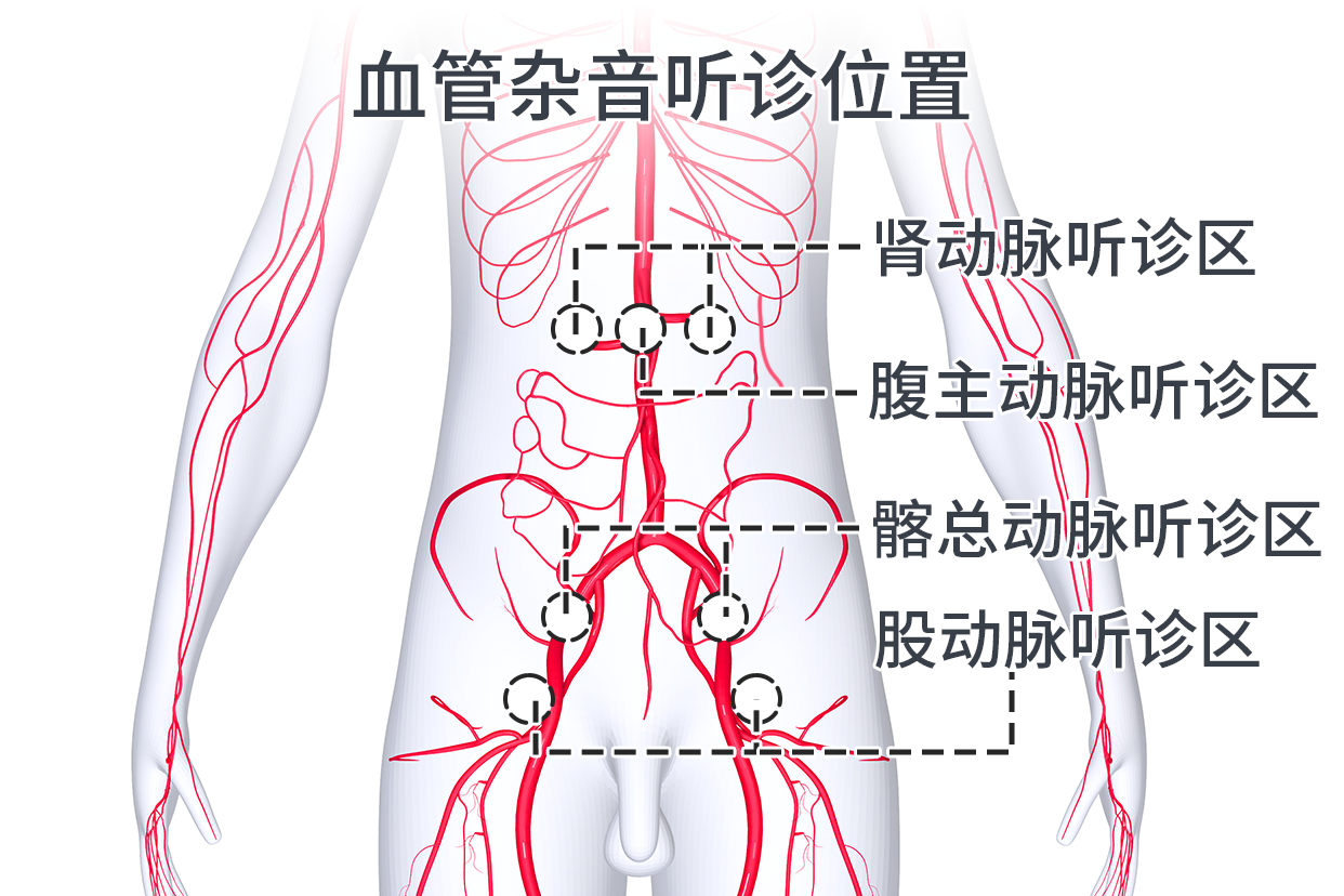 听诊器部位名称图片图片