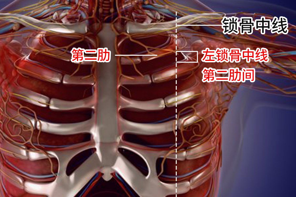 左锁骨中线第二肋间图片