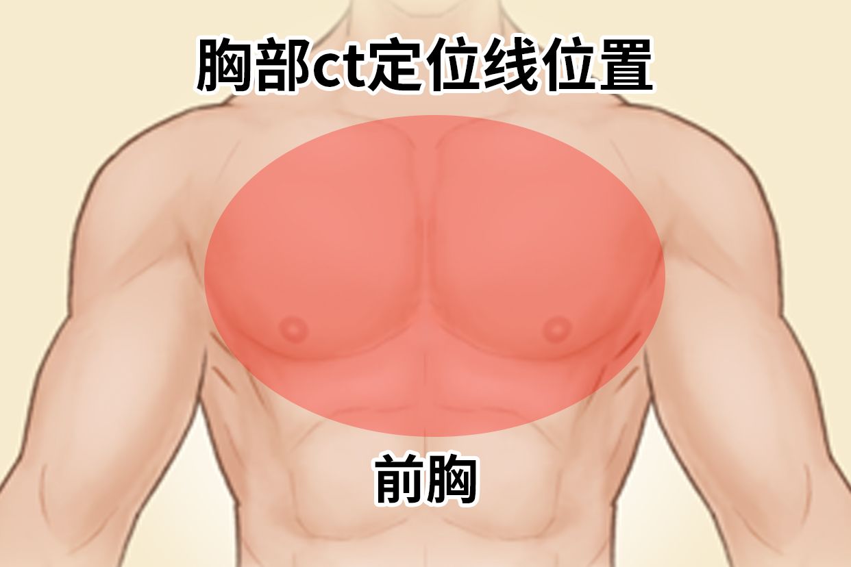 胸部ct定位线位置图片