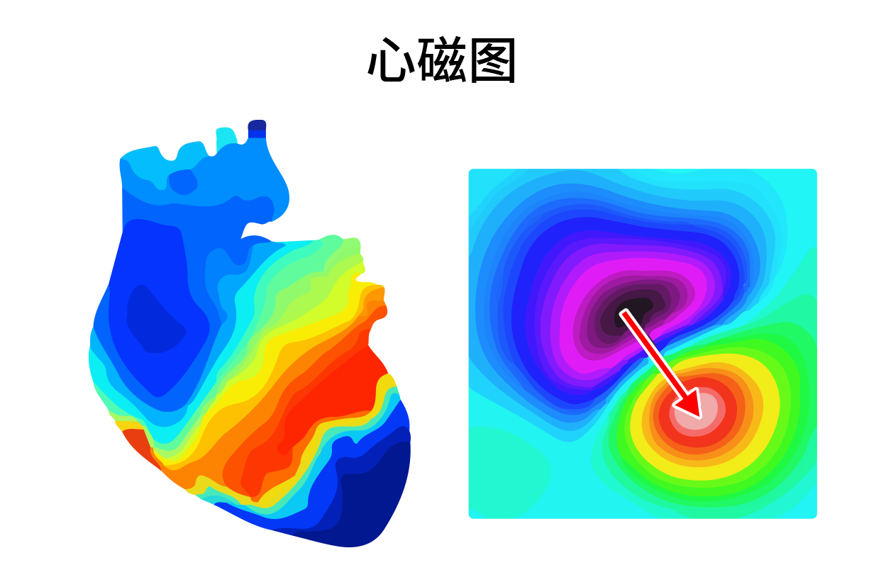 心磁图和心电图区别图
